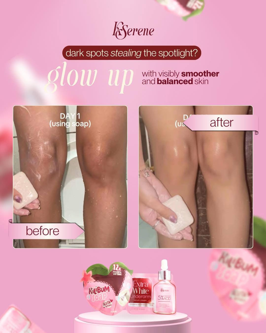 KSerene - Kilibum Soap 70g x 3/Pack