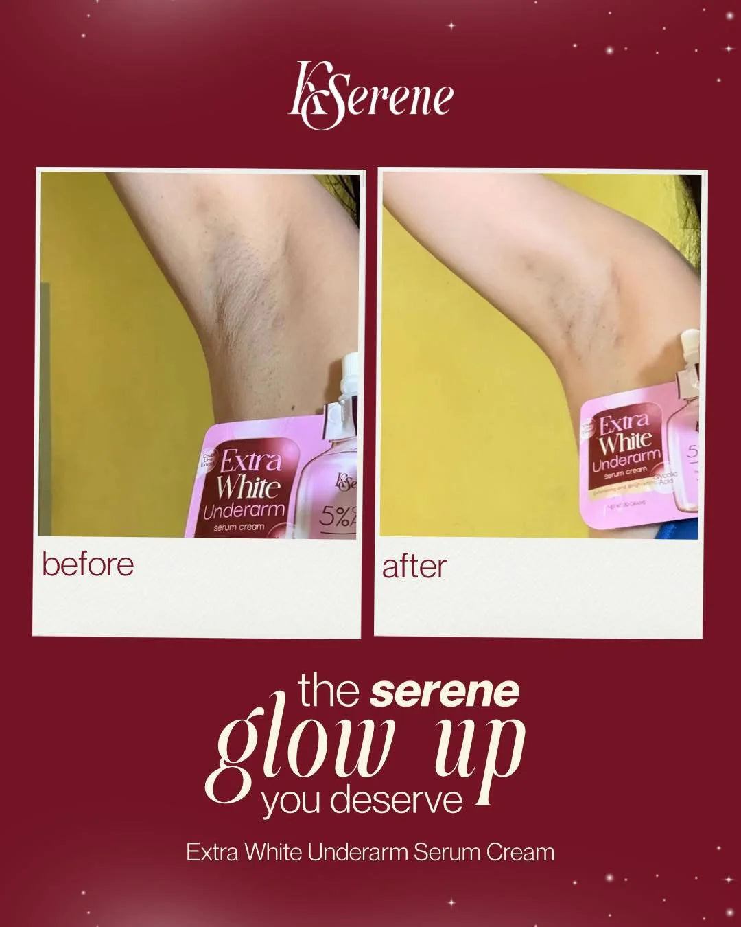 KSerene - Extra White Underarm Cream 30g