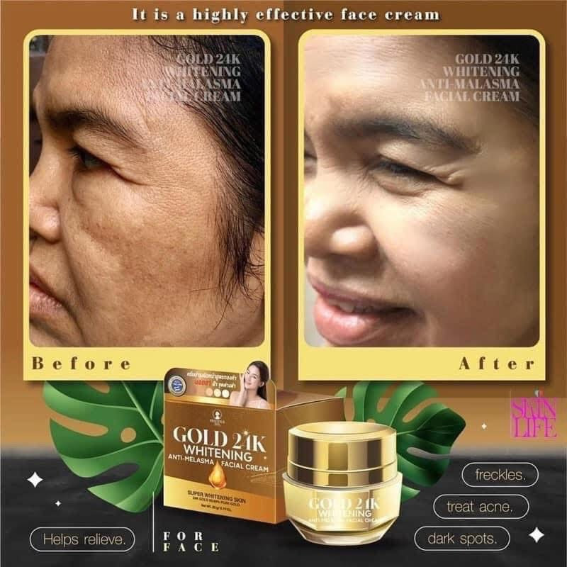 Precious Skin - 24k Anti-Melasma Facial Cream