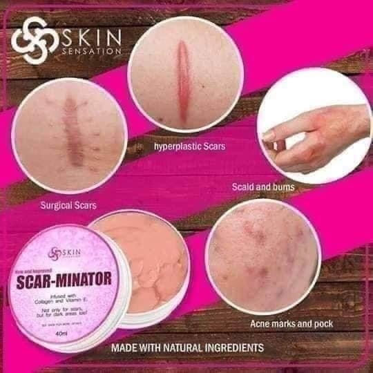 Skin Sensation - Scar-Minator All in One Cream