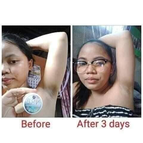 NRB Magic Underarm Whitening cream