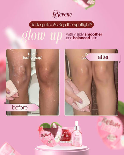 KSerene - Kilibum Soap 70g x 3/Pack