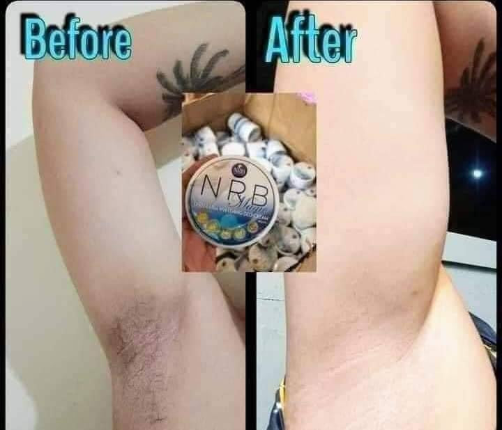 NRB Magic Underarm Whitening cream