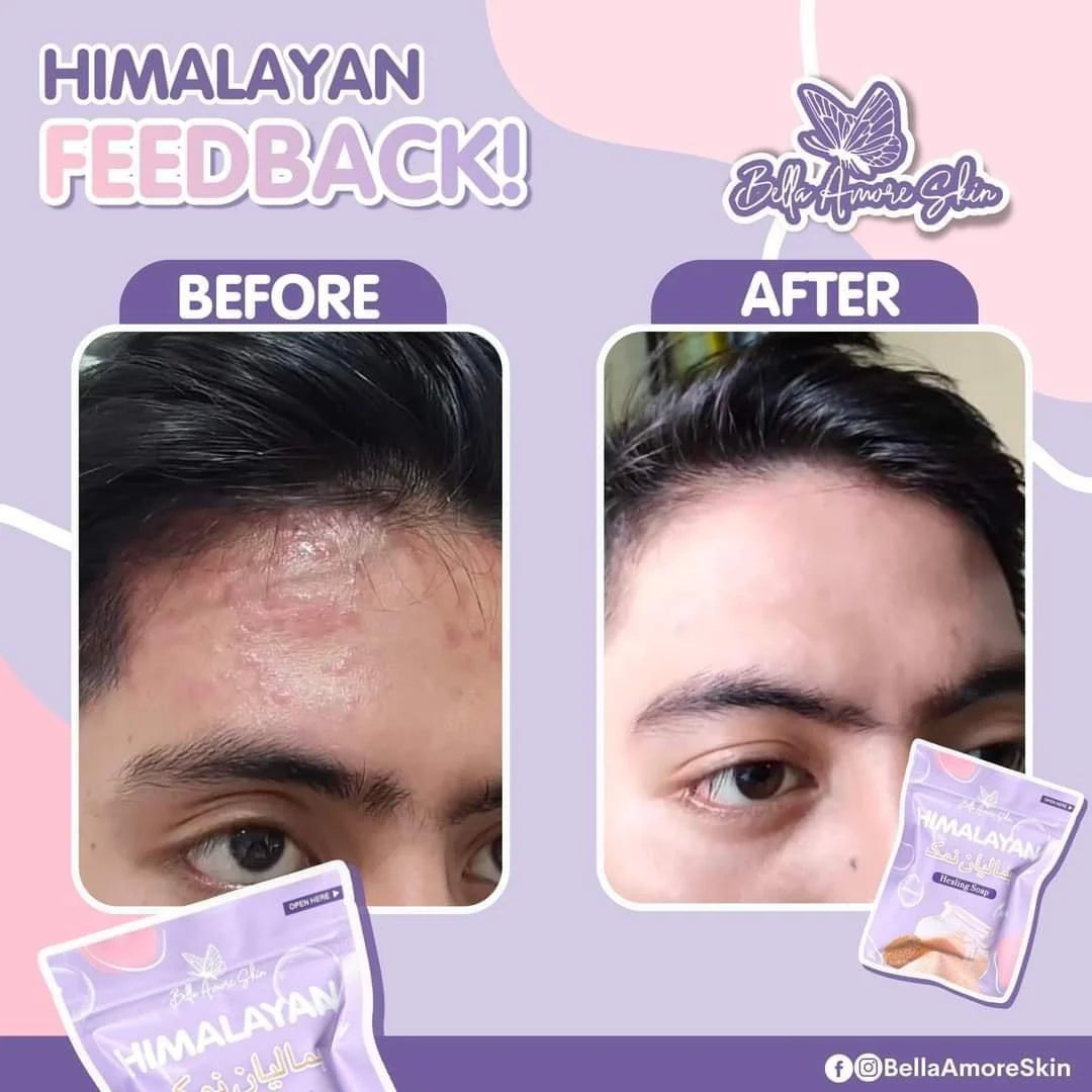 Bella Amore Skin Himalayan Bar soap 130g