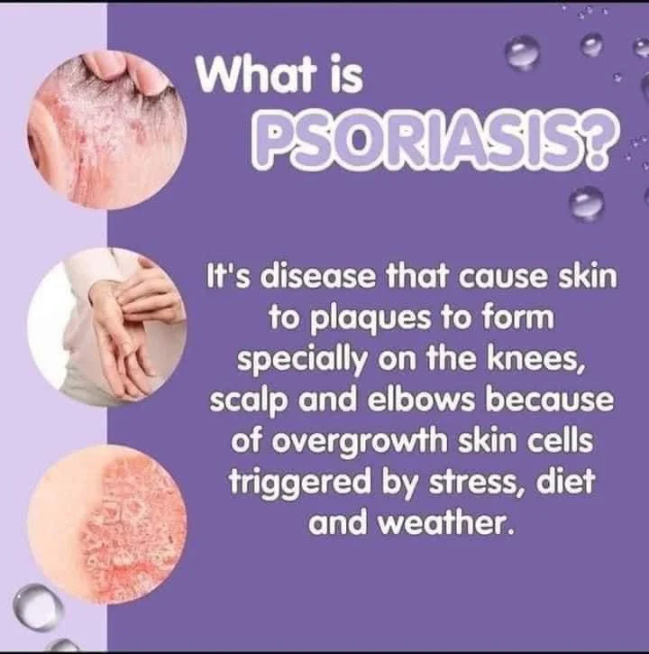 Bella Amore Skin Himalayan Bar soap 130g