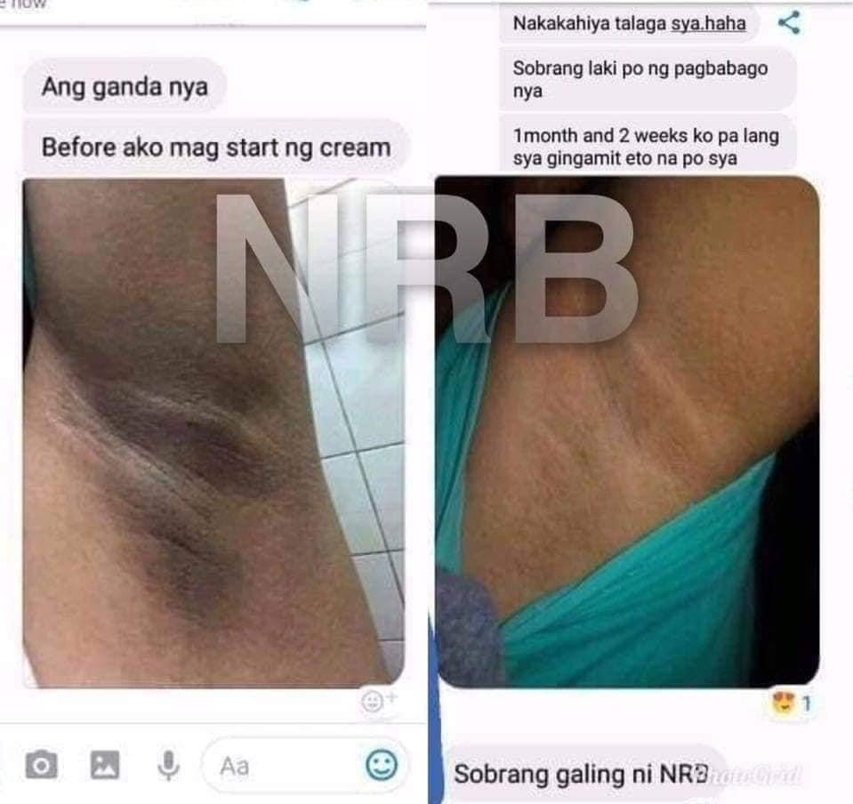 NRB Magic Underarm Whitening cream