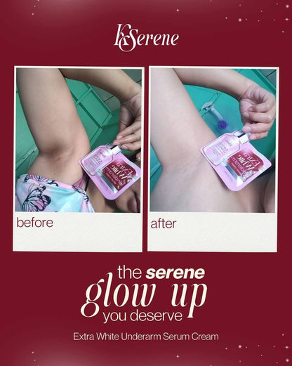KSerene - Extra White Underarm Cream 30g