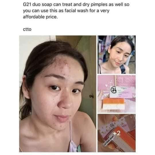 g21 glutathione review Want to learn more about the Golden Dust Lotion? Check out these quick facts: Fast-Drying Formula: Say goodbye to wait time! Hydrates and Moisturizes: Keep your skin feeling nourished. Instant Whitening FITNESS LOVE Glutathione Gummies