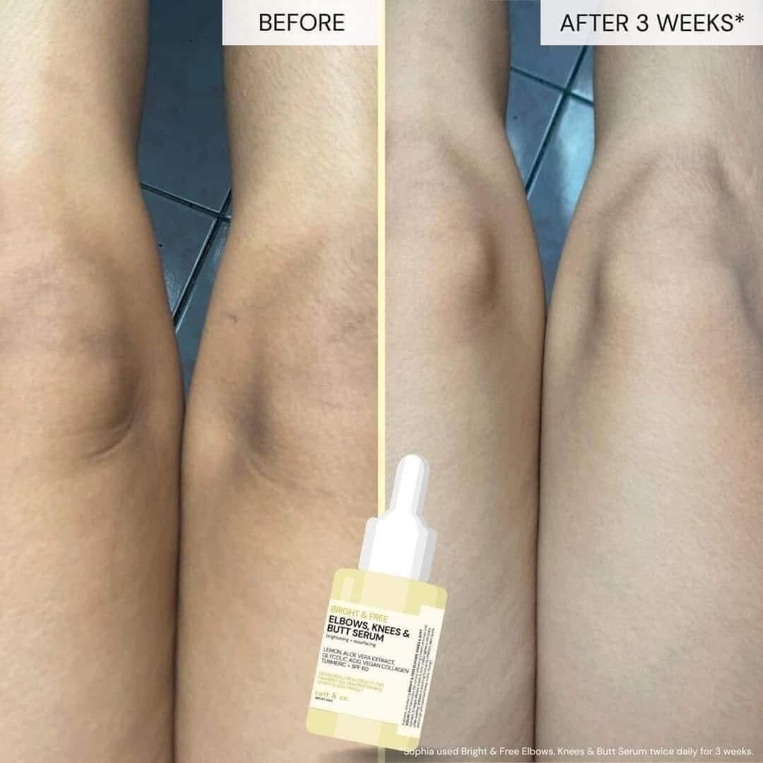 Catt & co. Elbows, Knees and Butt Serum 30ml