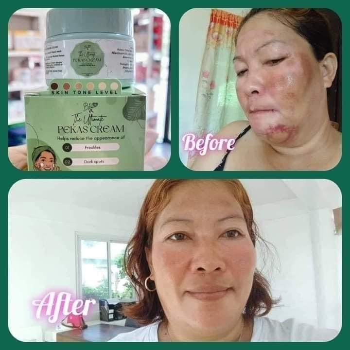 Dr Blem Ultimate Pekas Cream 15g