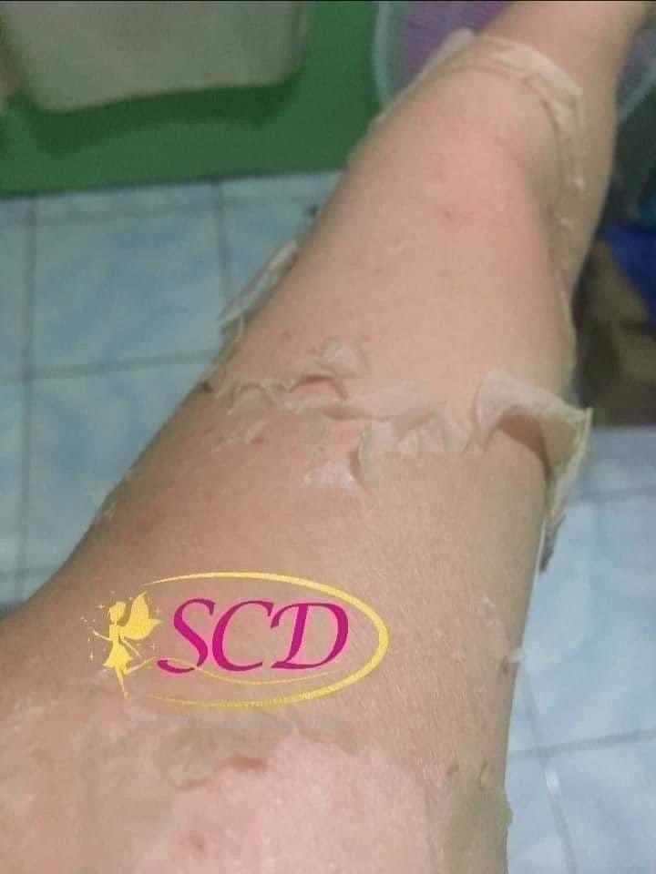 SCD Peeling Skin Lotion 100ml - Shop Essential Skin Care Products online | Natural Organic skin care products | ROSYSKIN ESSENTIALS LLC