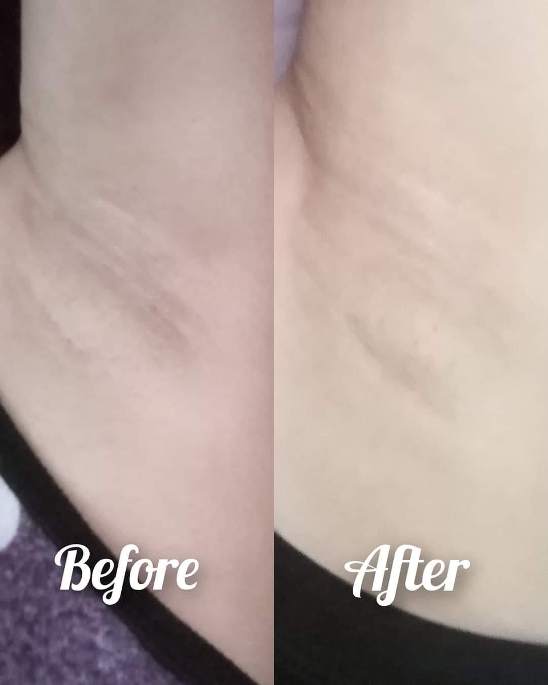 88 Total white ( underarm whitening cream) - Shop Essential Skin Care Products online | Natural Organic skin care products | ROSYSKIN ESSENTIALS LLC