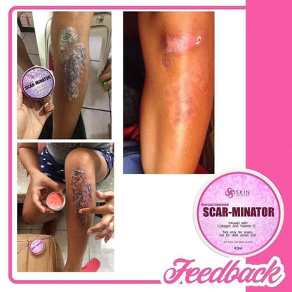 Skin Sensation - Scar-Minator All in One Cream