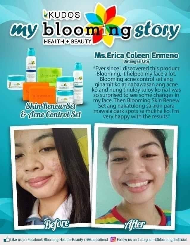 BLOOMING SKIN RENEWAL FACIAL SET - Shop Essential Skin Care Products online | Natural Organic skin care products | ROSYSKIN ESSENTIALS LLC