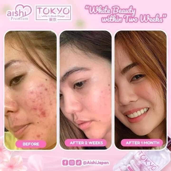 Aishi- TOKYO White | Block Dfyage | Glutathione 60caaps ROSYSKIN ESSENTIALS LLC Aishi- TOKYO White | Block Dfyage | Glutathione 60caaps ROSYSKIN ESSENTIALS LLC