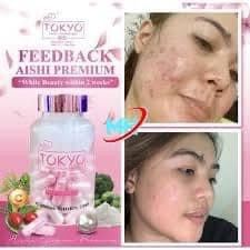 Aishi- TOKYO White | Block Dfyage | Glutathione 60caaps ROSYSKIN ESSENTIALS LLC Aishi- TOKYO White | Block Dfyage | Glutathione 60caaps ROSYSKIN ESSENTIALS LLC