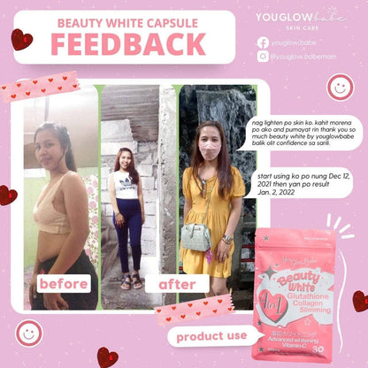 You glow babe Beauty White - Glutathione Collagen Slimming 30Caps