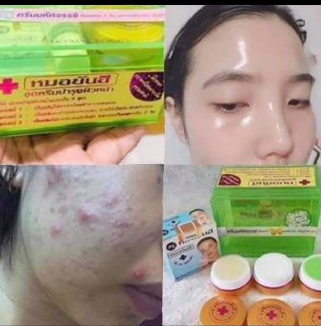Dr. Yahnee Green Set - Shop Essential Skin Care Products online | Natural Organic skin care products | ROSYSKIN ESSENTIALS LLC